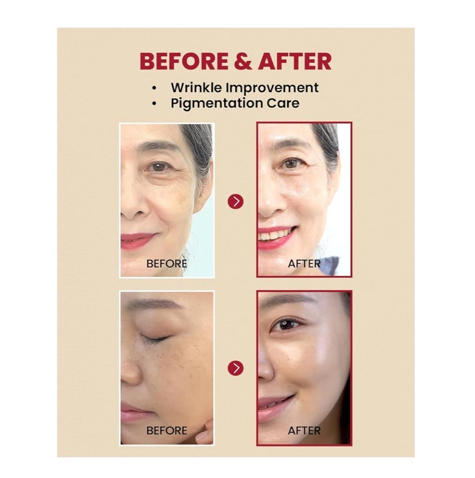 Serum Retinal 2% con Ginseng negro- Seoul 1988 - Ksecret