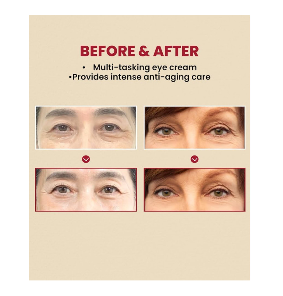 Retinal 4% - Contorno de ojos - Seoul 1988 - Ksecret