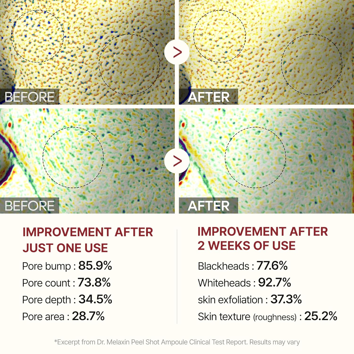 DR.MELAXIN | Serum Shot Glow Arroz Negro | Exfoliante | 80ml - top