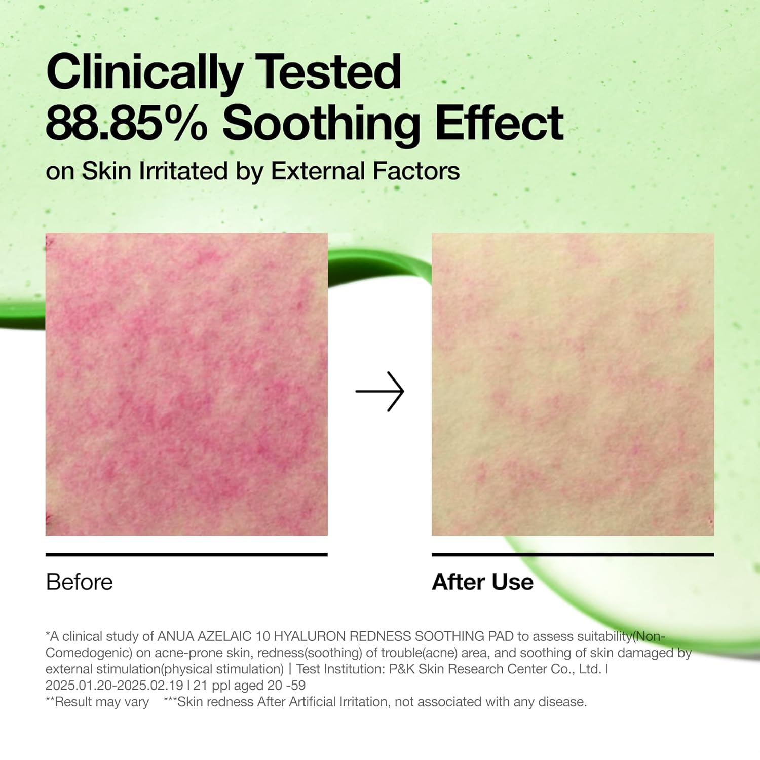 Anua | Pads Calmantes | Acido Azelaico 10% y Acido Hialuronico | 90 Pads