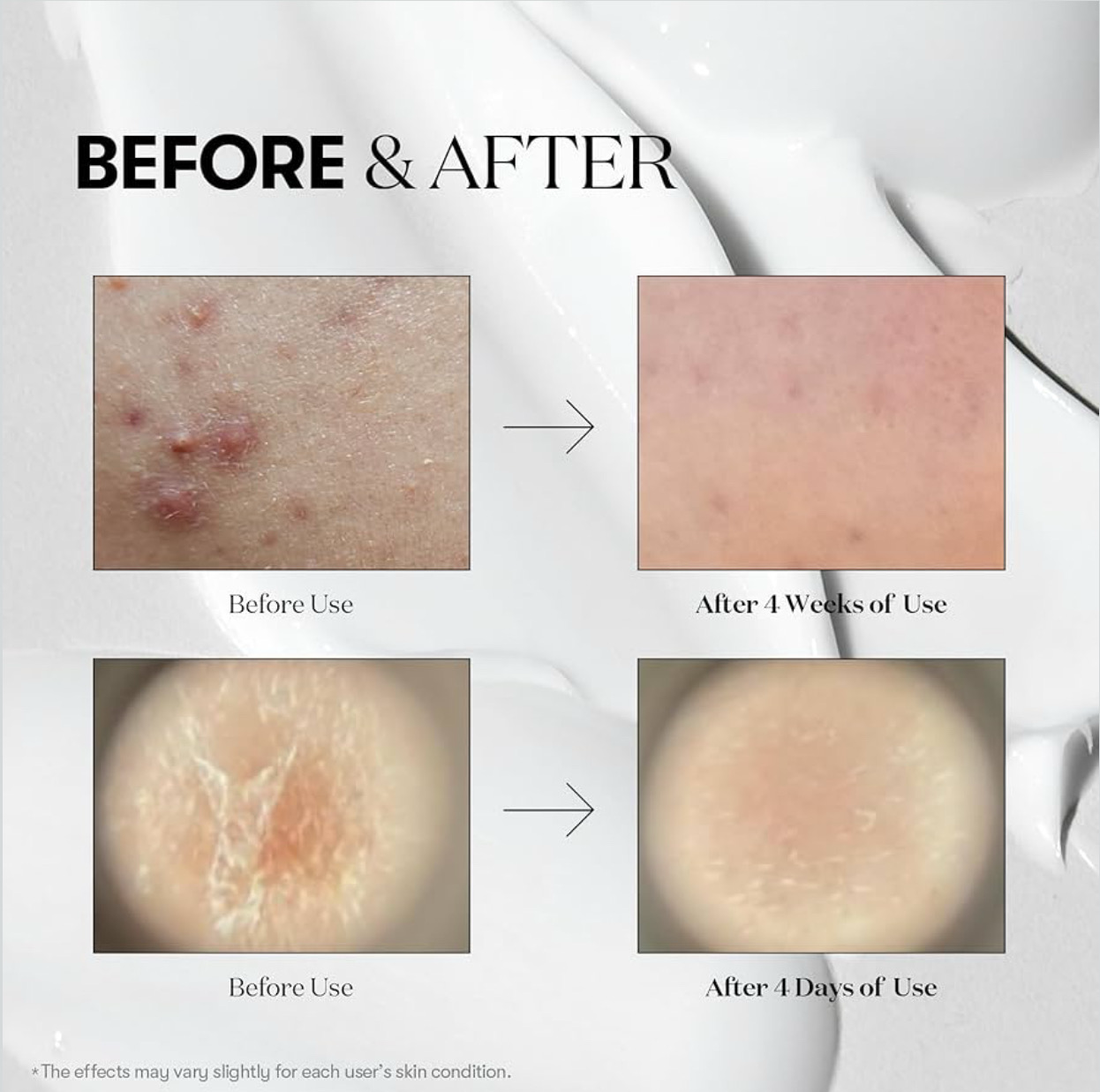 Serum Reedle Shot - Trio 100, 300, 700