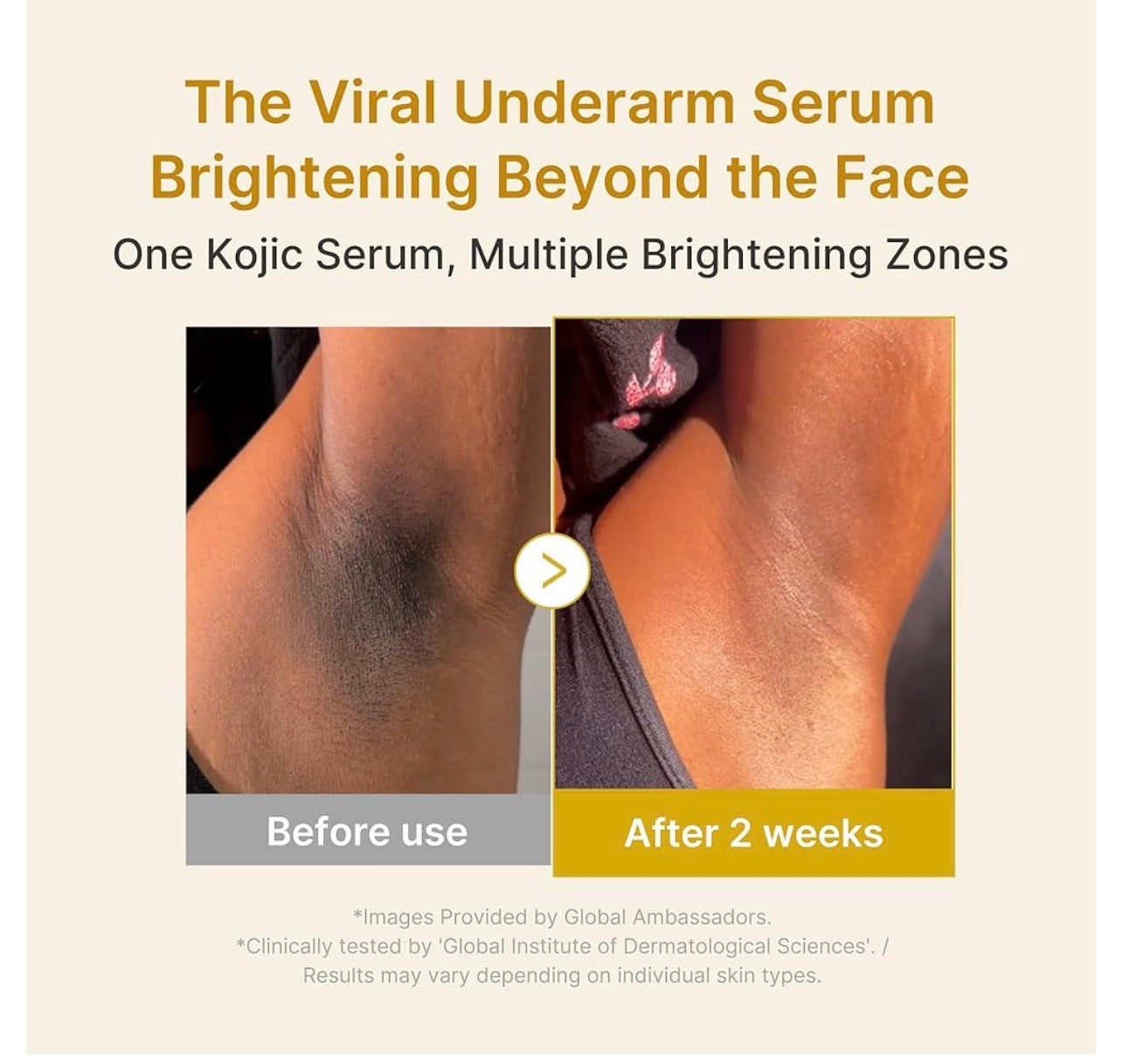 Serum aclarante con Niacinamida - Curcuma- Acido Kojico | Medicube